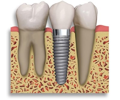 Lyr Dent - clinica stomatologica